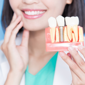 Qual a diferença entre implante dentário e prótese fixa?